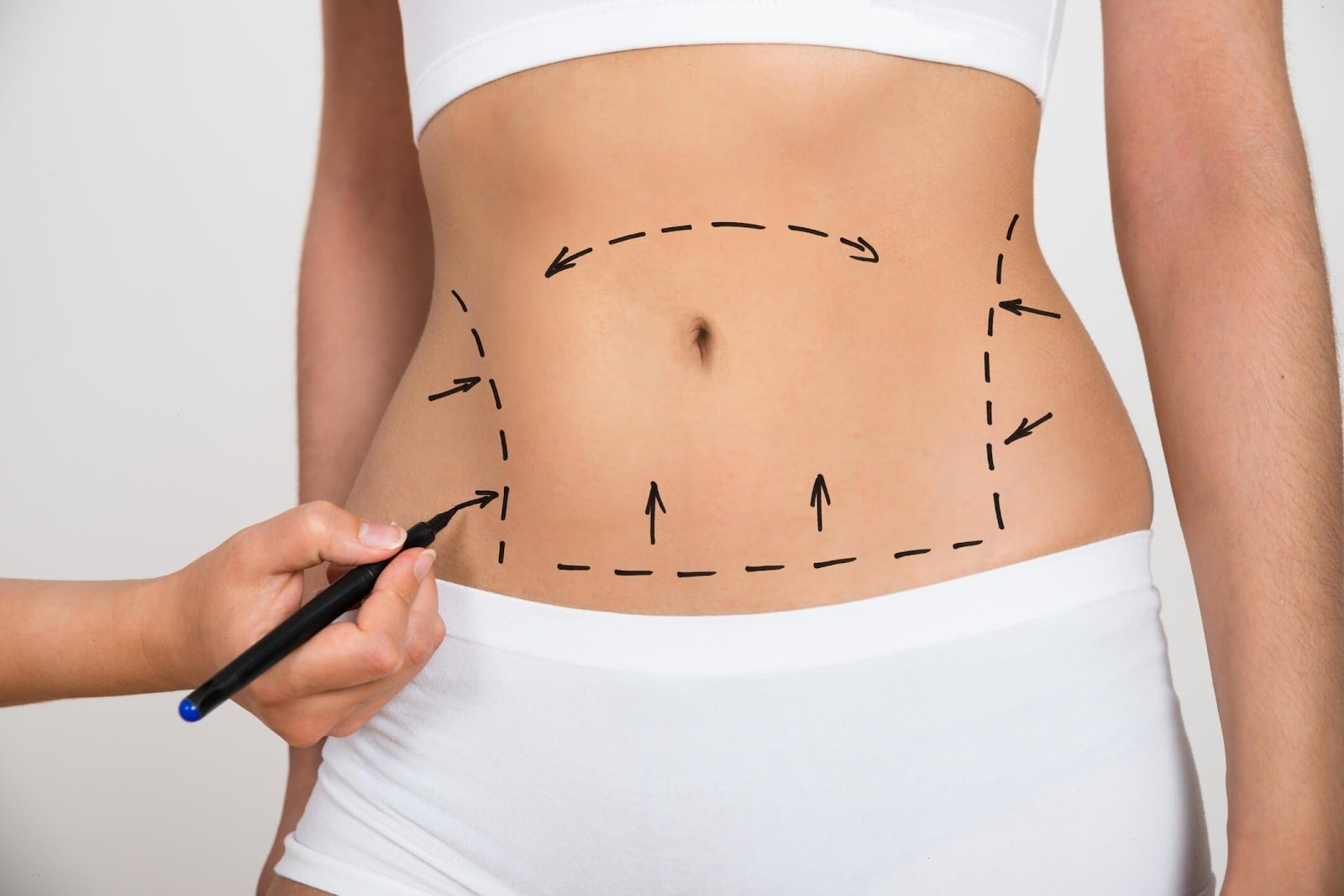 tummy tuck in turkey