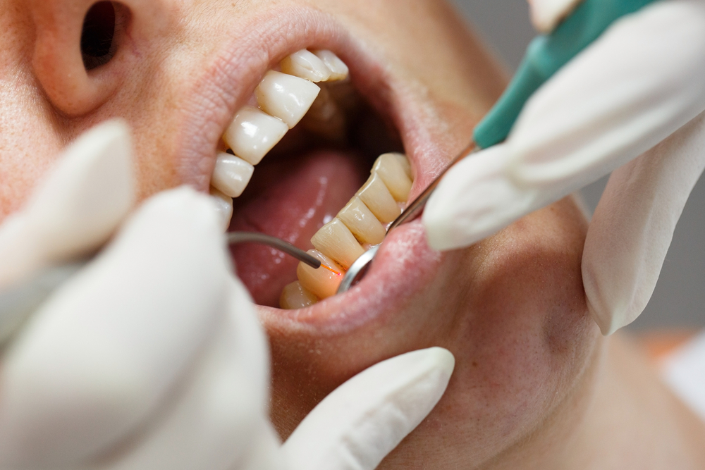 Why Dental Treatments Are Cheap In Turkey? related image