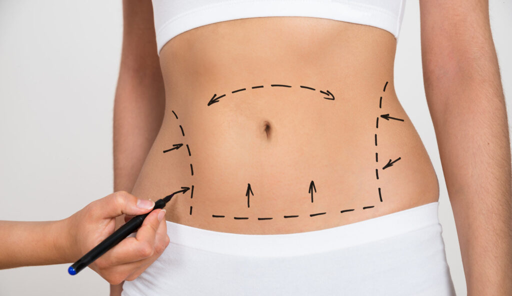 Plastic Surgery in Turkey: Procedures, Surgeons & Costs 2025 related image