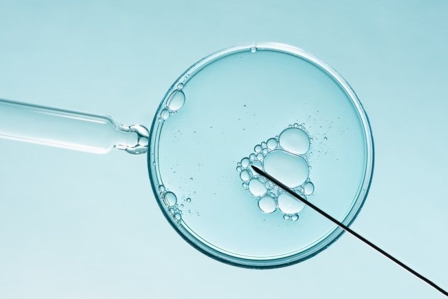 IVF in Turkey: High Success, Low Cost, No Waiting related image