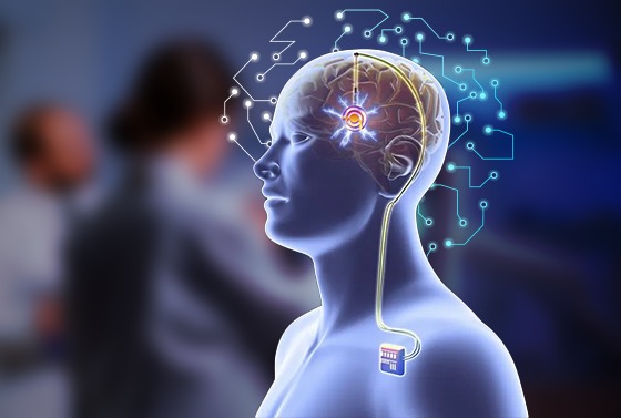 DBS, FUS, or Rehab? Choosing the Right Parkinson’s Treatment related image