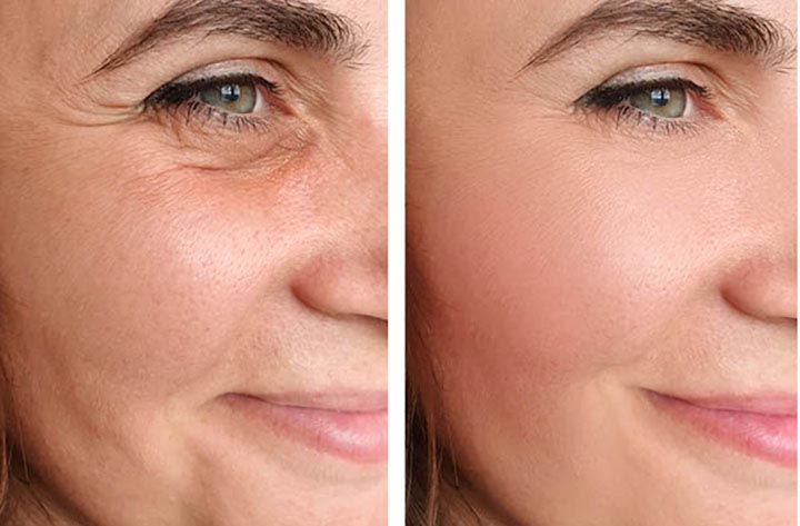 Plastic Surgery in Turkey: Procedures, Surgeons & Costs 2025 related image