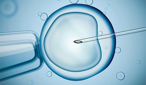 8 Best and Cheapest Countries for IVF Treatment Abroad related image