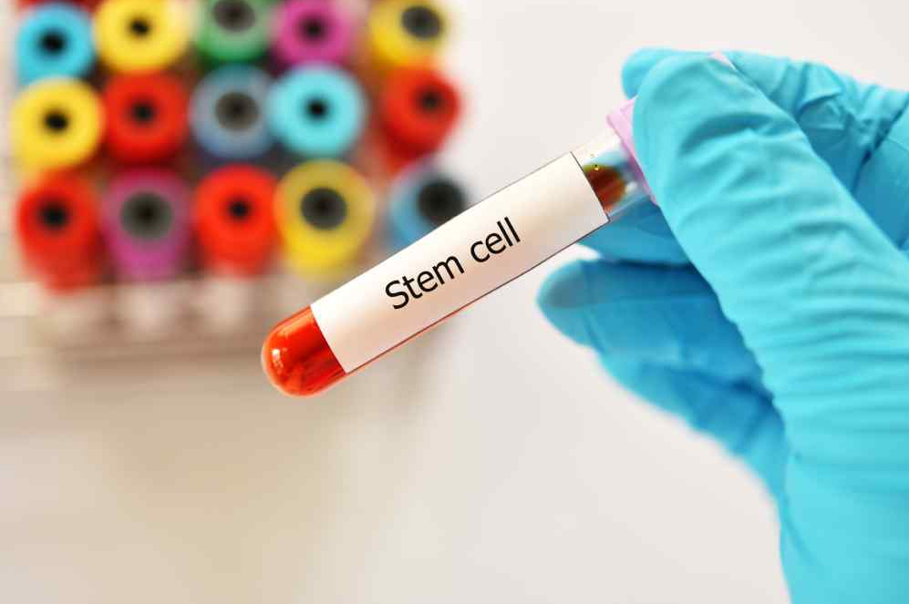 Stem Cell Therapy in Turkey: Costs, Clinics and Benefits related image