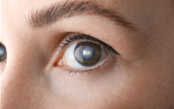 Ophthalmology Clinics in Switzerland & Best Ophthalmologists related image