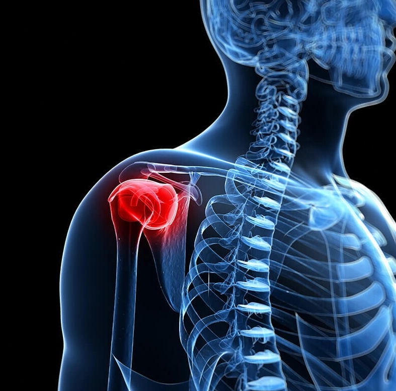 Best Clinics Offering Shoulder Pain Stem Cell Therapy related image