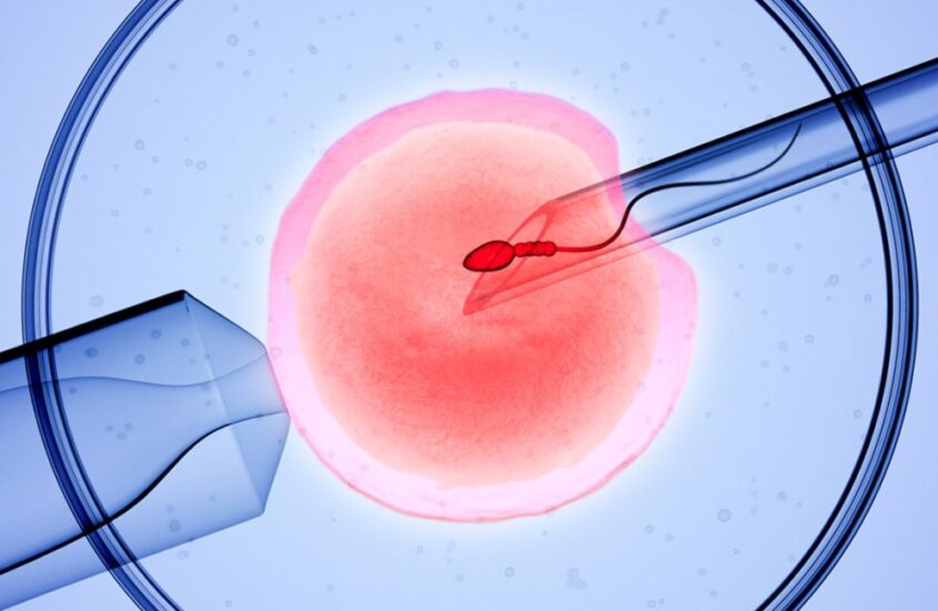 IVF in Turkey: What to Know Before You Start Your Treatment related image