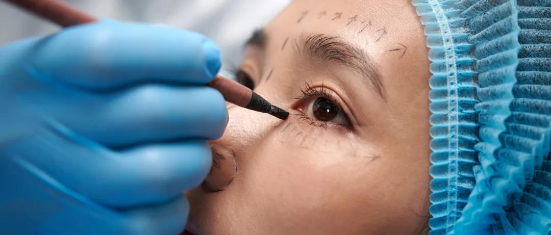 Plastic Surgery in Turkey: When It’s Safe and When It’s Not related image