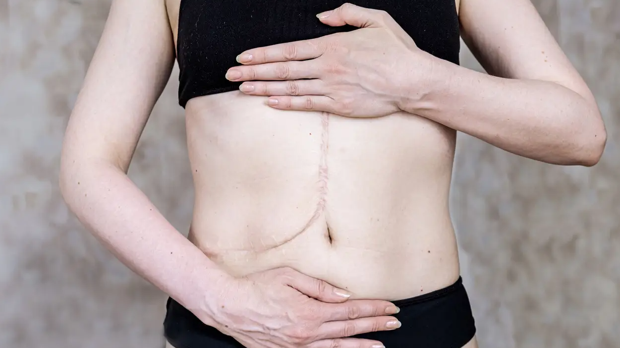 Liver Transplant in Turkey - Clinics, Costs, Surgeons (2026) related image