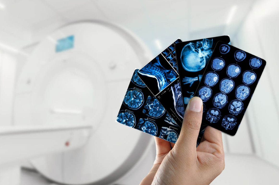 Multiple Sclerosis Treatment in Turkey: Costs, Clinics & Doctors related image