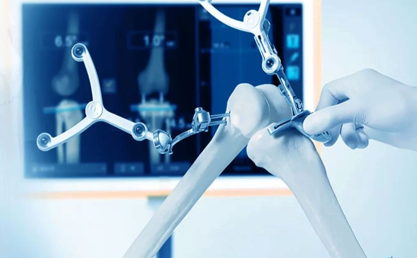 Best and Cheapest Countries for Hip Replacement Surgery Abroad related image