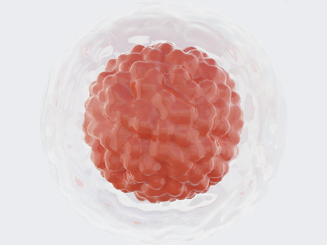 Best Countries and Clinics for Bone Marrow Transplant related image