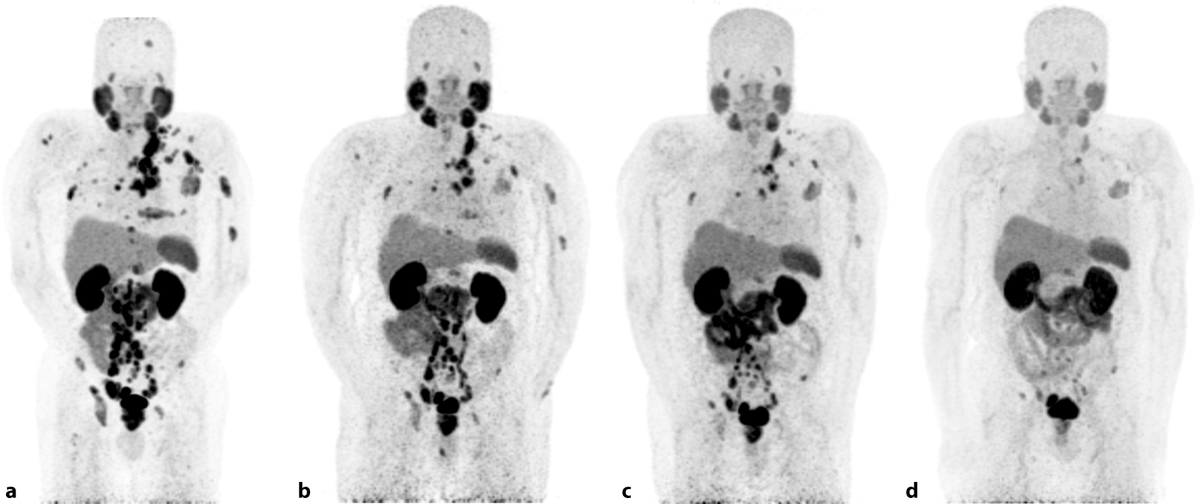 Voyaga etgan qoramagiz jinni
