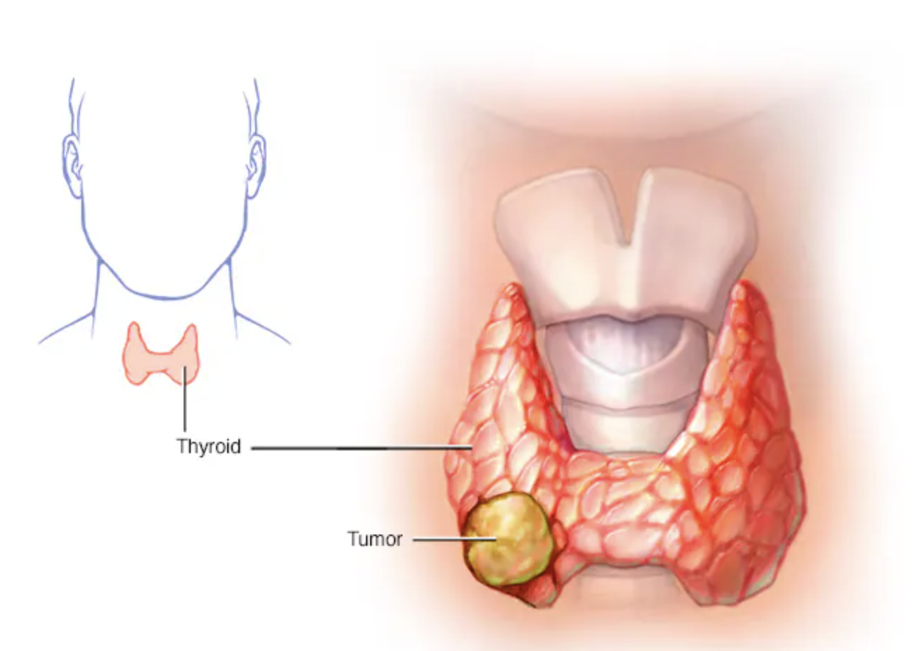 Ukrainadan etuklar porno